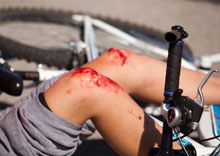 Hit-and-Run Bike Accidents